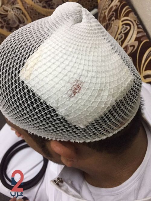 تفاصيل اعتداء طالب على معلم نتج عنه “6” غرز في رأسه
